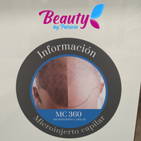 Microinjertos capilares en Beauty By Patricia: solución eficaz para la pérdida de cabello