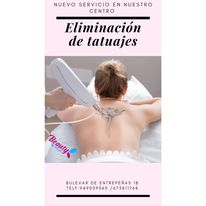 Servicio de eliminación de tatuajes: ¡Elimina tu tatuaje no deseado en Beauty By Patricia!