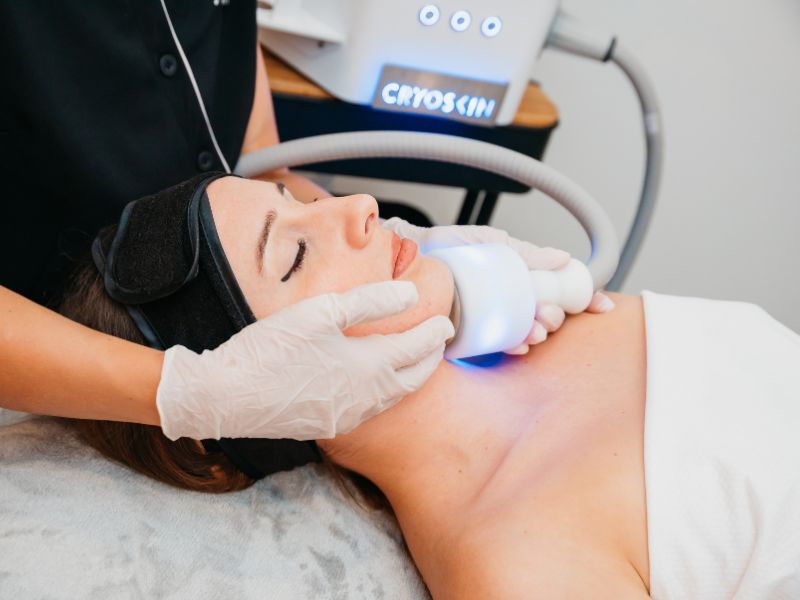 CRYOSKIN FACIAL BEAUTY BY PATRICIA